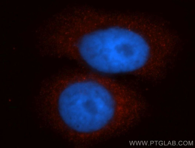 CTNNA3 Antibody in Immunocytochemistry (ICC/IF)