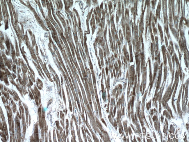 CTNNA3 Antibody in Immunohistochemistry (Paraffin) (IHC (P))