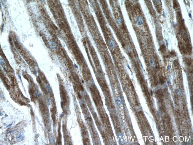 CTNNA3 Antibody in Immunohistochemistry (Paraffin) (IHC (P))