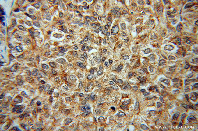 CTNNA3 Antibody in Immunohistochemistry (Paraffin) (IHC (P))