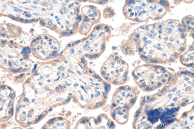 CTNNA3 Antibody in Immunohistochemistry (Paraffin) (IHC (P))