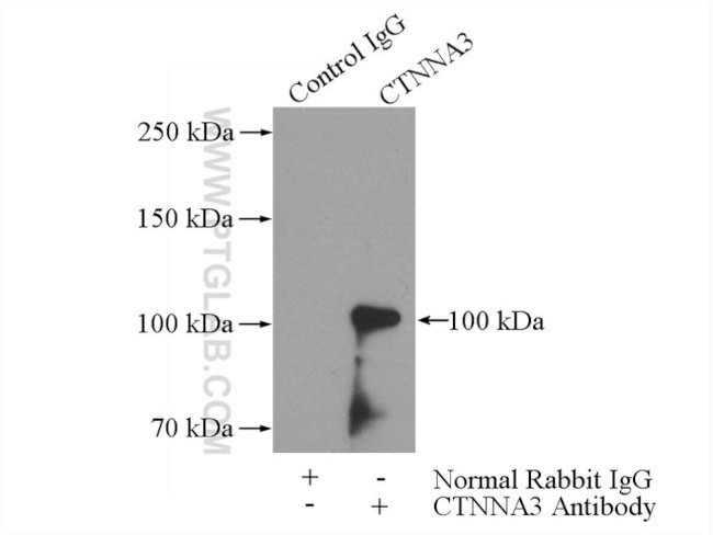 CTNNA3 Antibody in Immunoprecipitation (IP)