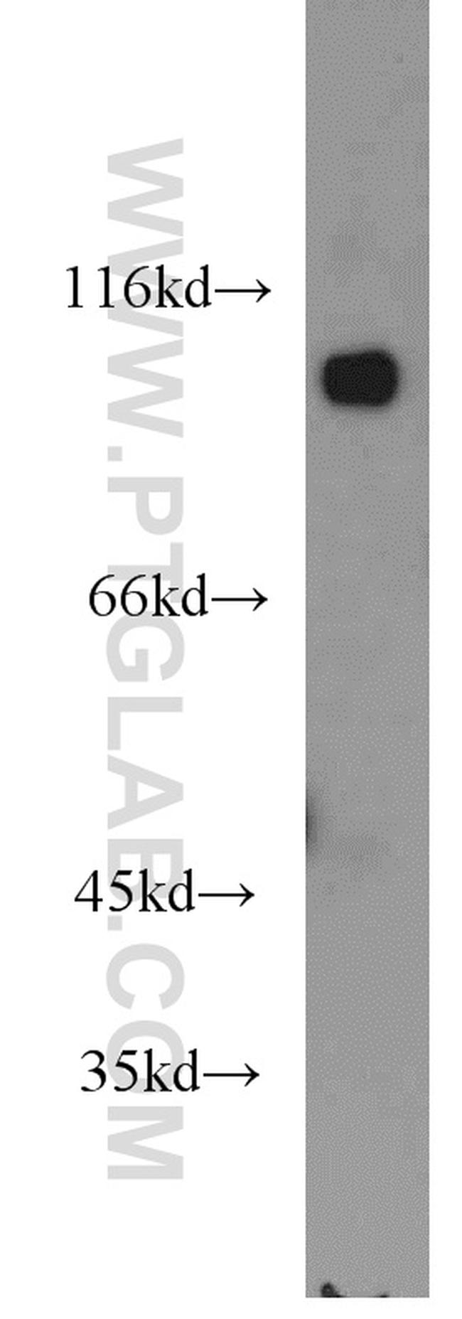 CTNNA3 Antibody in Western Blot (WB)