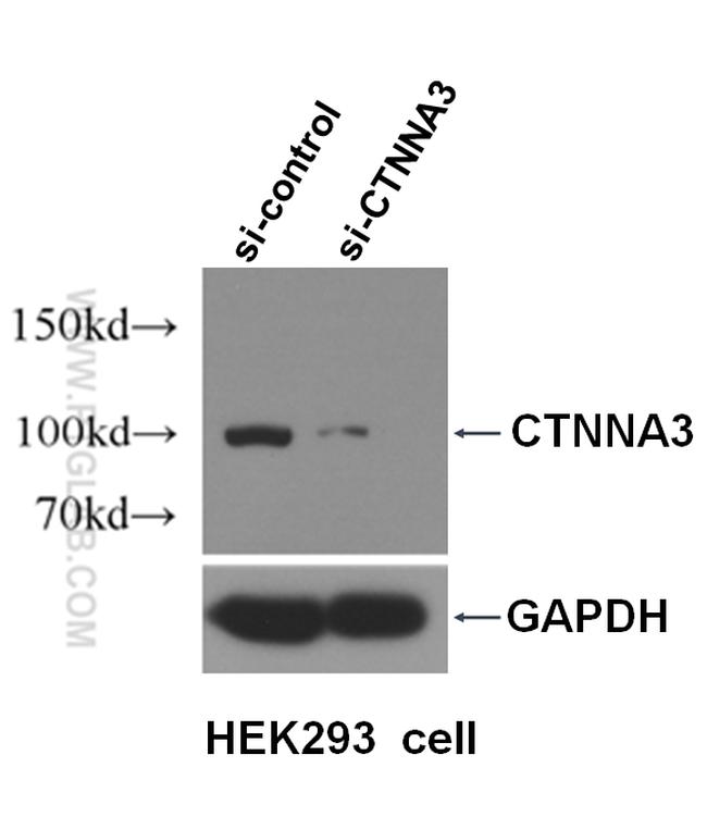 CTNNA3 Antibody in Western Blot (WB)