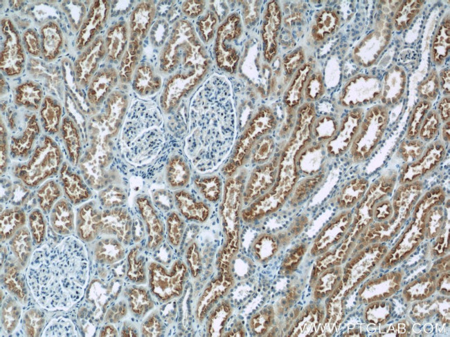 MKS3 Antibody in Immunohistochemistry (Paraffin) (IHC (P))