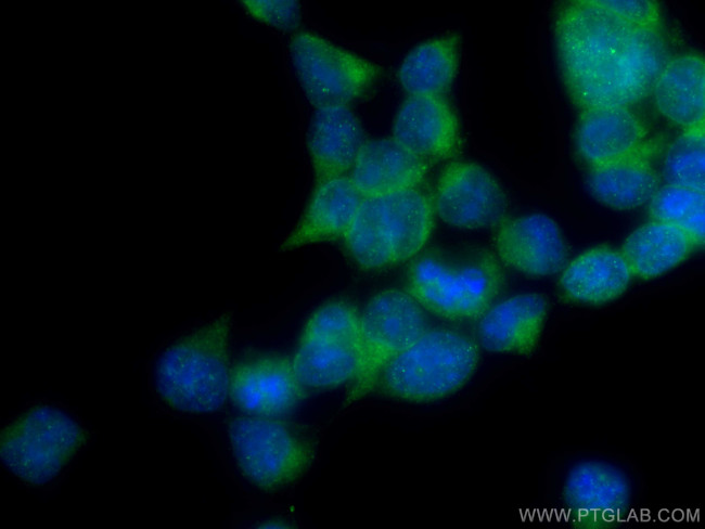 SEC63 Antibody in Immunocytochemistry (ICC/IF)