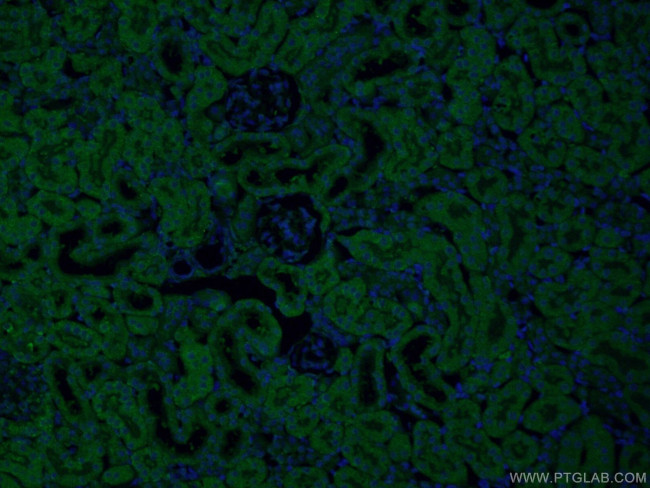 SEC63 Antibody in Immunohistochemistry (PFA fixed) (IHC (PFA))