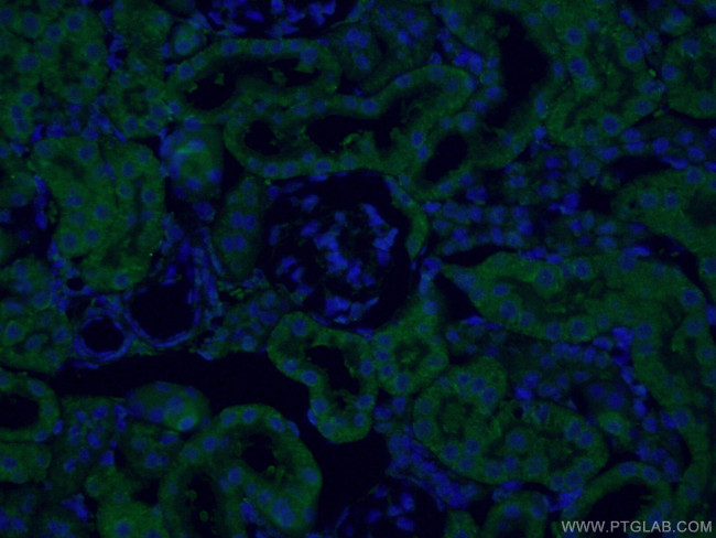 SEC63 Antibody in Immunohistochemistry (PFA fixed) (IHC (PFA))