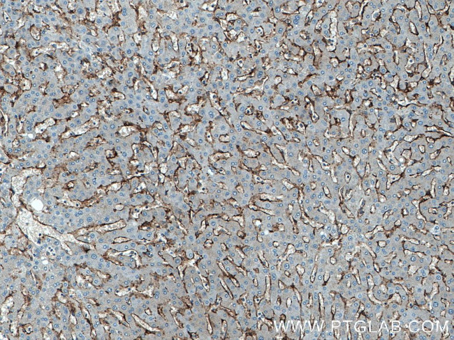 SEC63 Antibody in Immunohistochemistry (Paraffin) (IHC (P))