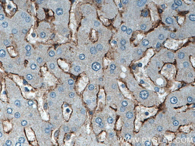 SEC63 Antibody in Immunohistochemistry (Paraffin) (IHC (P))