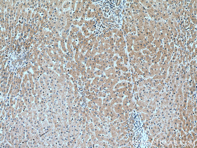 SEC63 Antibody in Immunohistochemistry (Paraffin) (IHC (P))