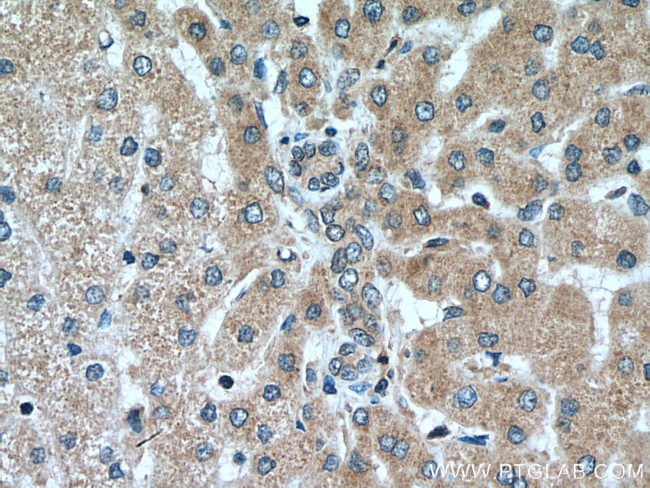 SEC63 Antibody in Immunohistochemistry (Paraffin) (IHC (P))