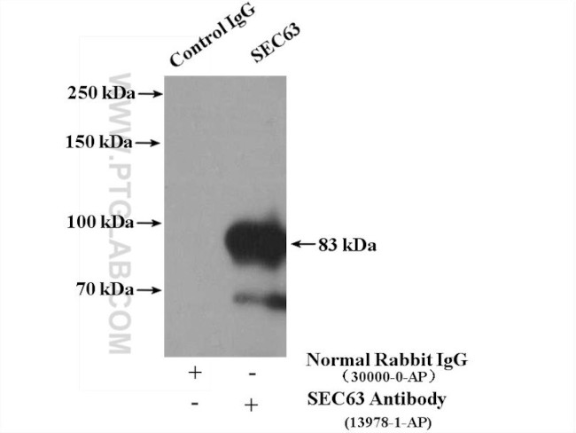 SEC63 Antibody in Immunoprecipitation (IP)