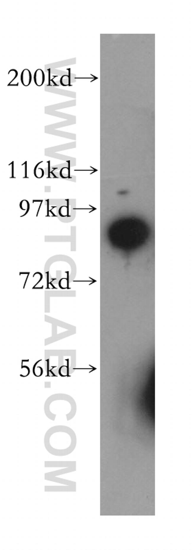 SEC63 Antibody in Western Blot (WB)