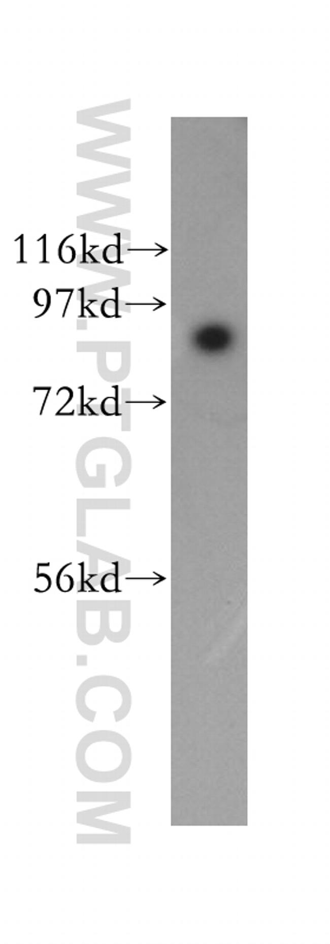 SEC63 Antibody in Western Blot (WB)