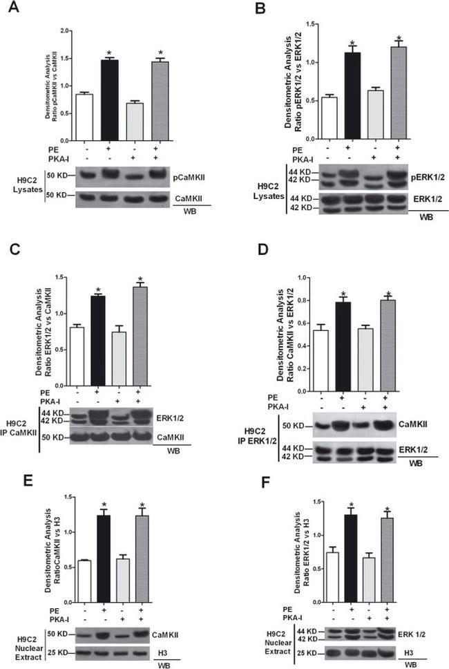 CaMKII beta Antibody in Western Blot (WB)