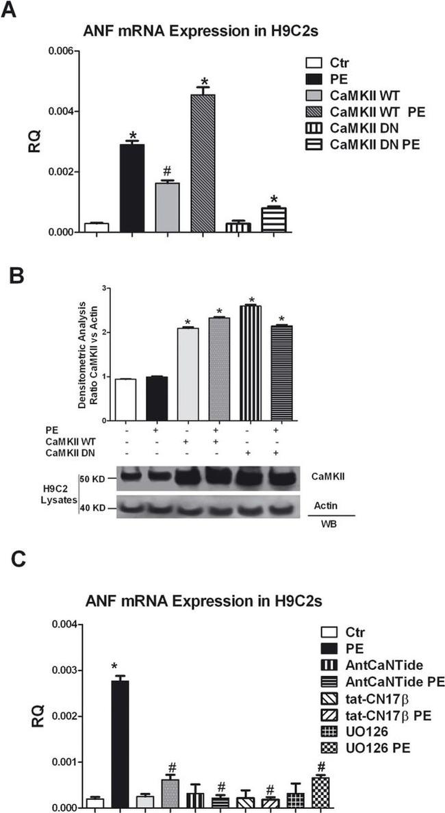 CaMKII beta Antibody in Western Blot (WB)