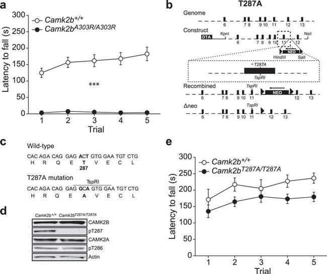 CaMKII beta Antibody in Western Blot (WB)