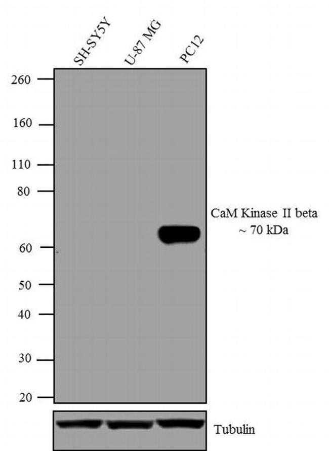 CaMKII beta Antibody in Western Blot (WB)