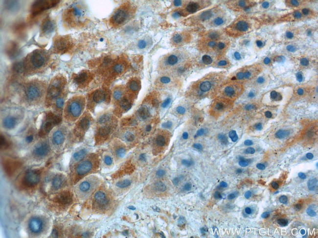 IGFBP1 Antibody in Immunohistochemistry (Paraffin) (IHC (P))