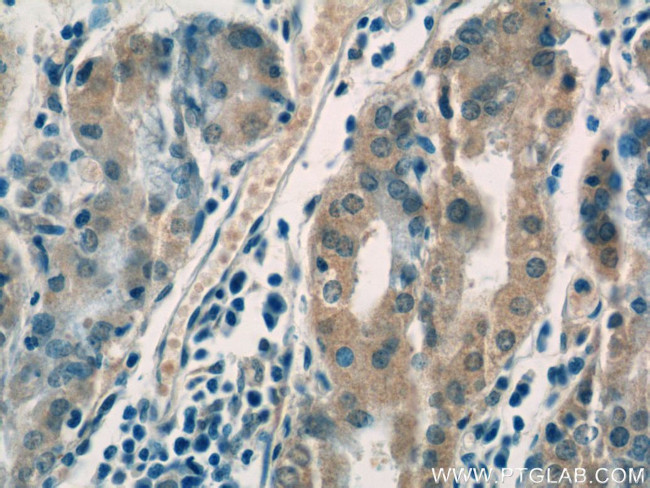 IGFBP1 Antibody in Immunohistochemistry (Paraffin) (IHC (P))