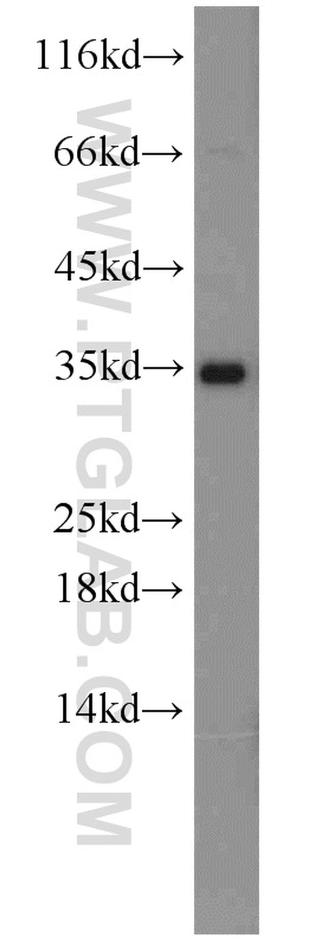 IGFBP1 Antibody in Western Blot (WB)