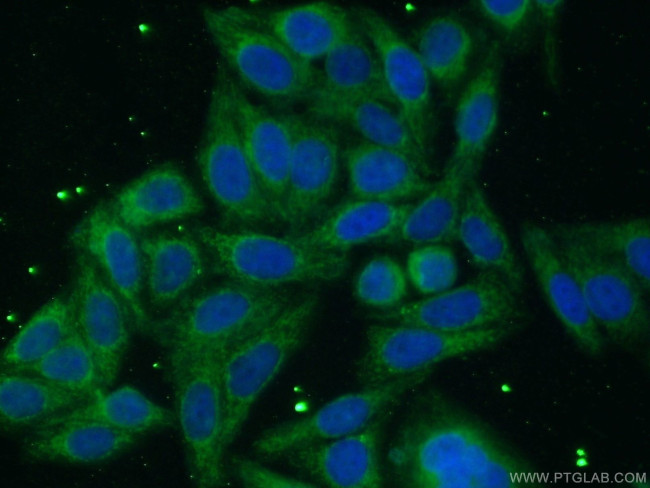 ACSL1 Antibody in Immunocytochemistry (ICC/IF)