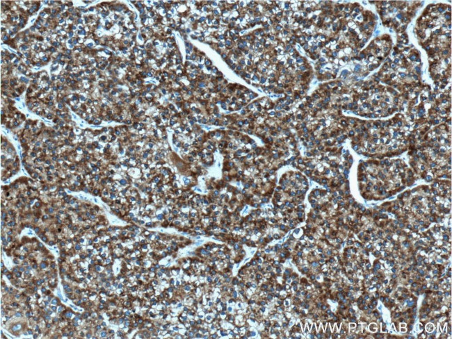 ACSL1 Antibody in Immunohistochemistry (Paraffin) (IHC (P))