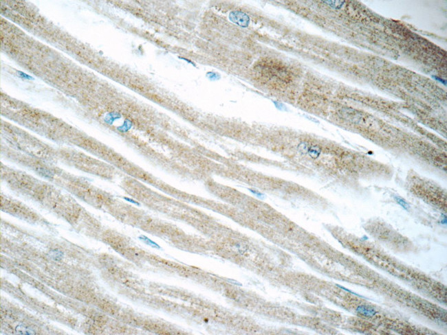 ACSL1 Antibody in Immunohistochemistry (Paraffin) (IHC (P))