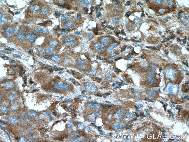 ACSL1 Antibody in Immunohistochemistry (Paraffin) (IHC (P))