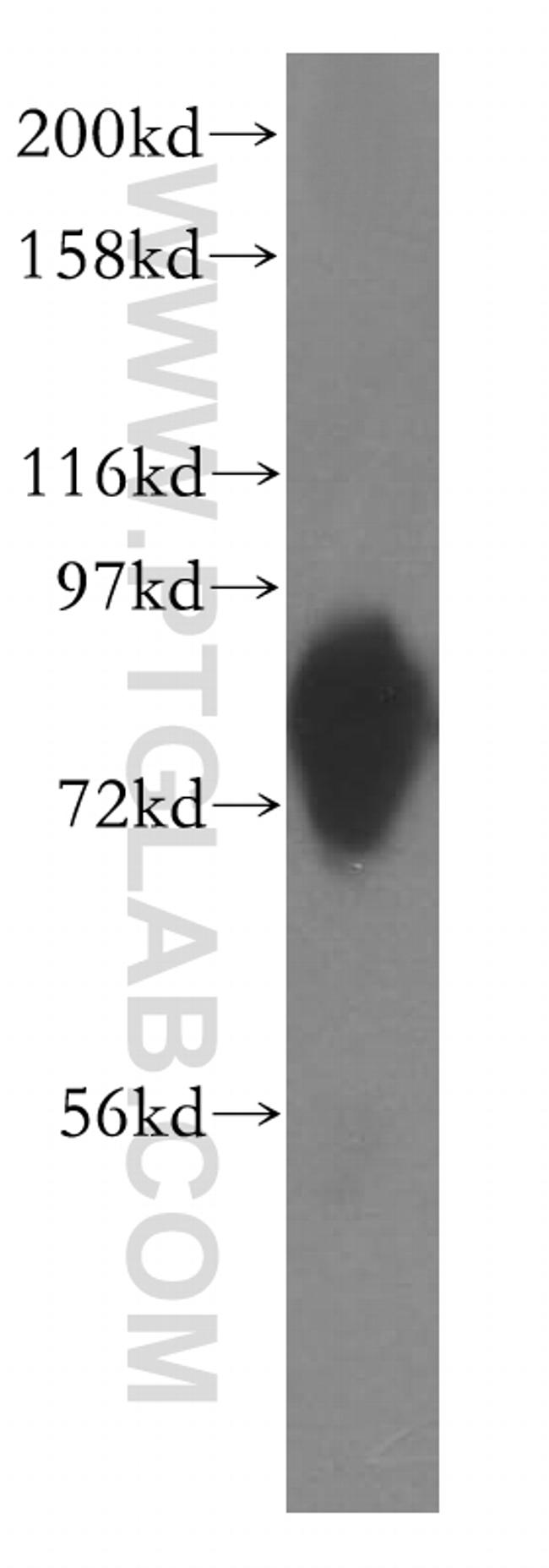 ACSL1 Antibody in Western Blot (WB)