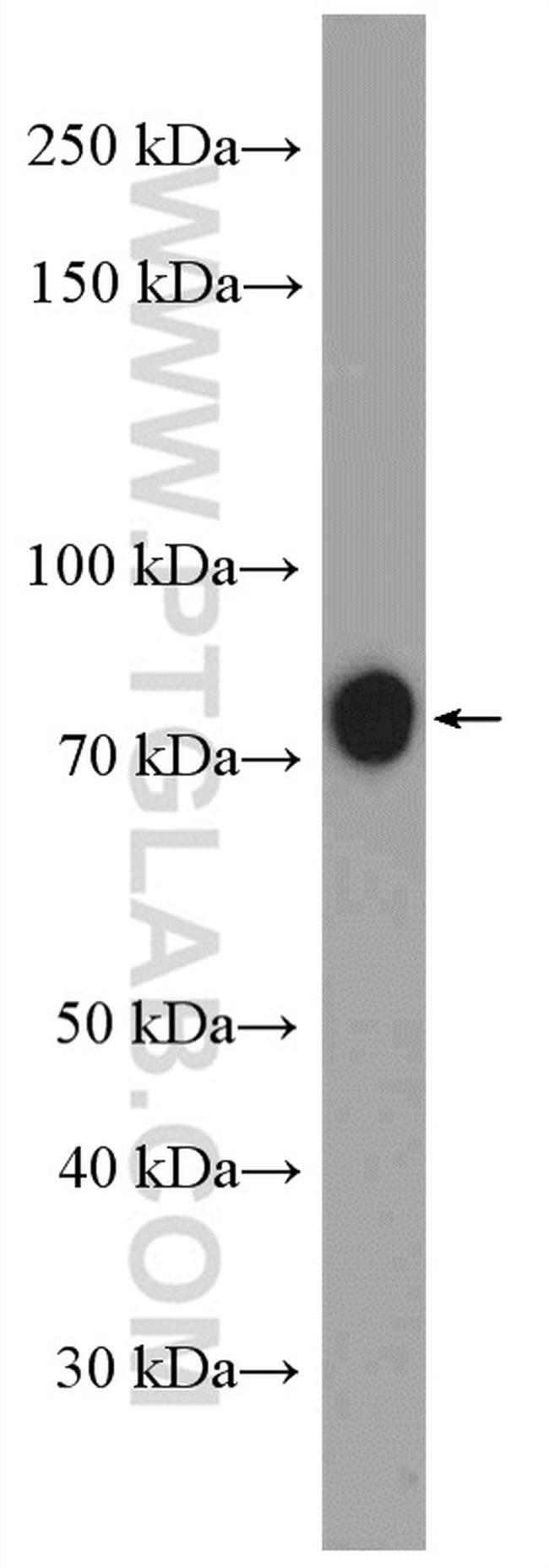 ACSL1 Antibody in Western Blot (WB)