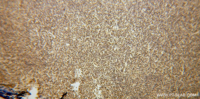 GRK2 Antibody in Immunohistochemistry (Paraffin) (IHC (P))