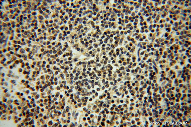 GRK2 Antibody in Immunohistochemistry (Paraffin) (IHC (P))