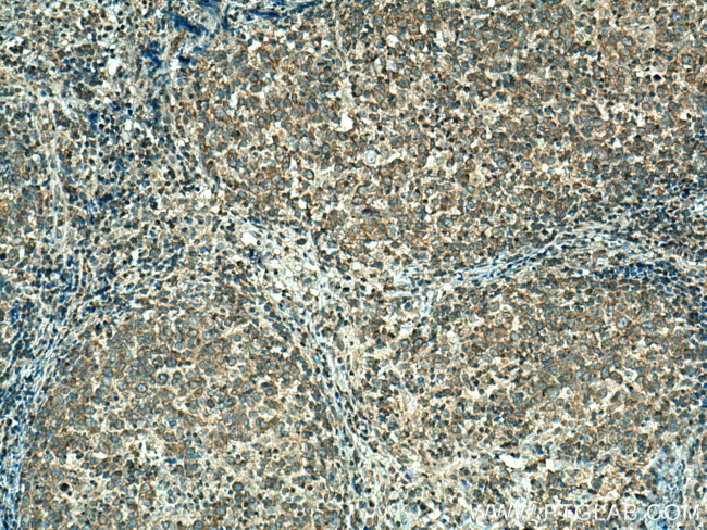 GRK2 Antibody in Immunohistochemistry (Paraffin) (IHC (P))