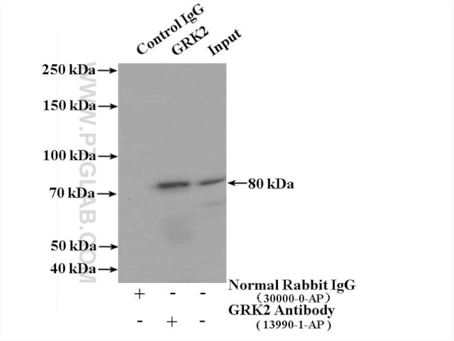 GRK2 Antibody in Immunoprecipitation (IP)