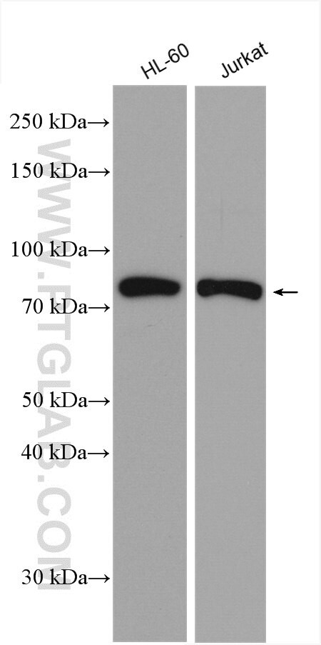 GRK2 Antibody in Western Blot (WB)