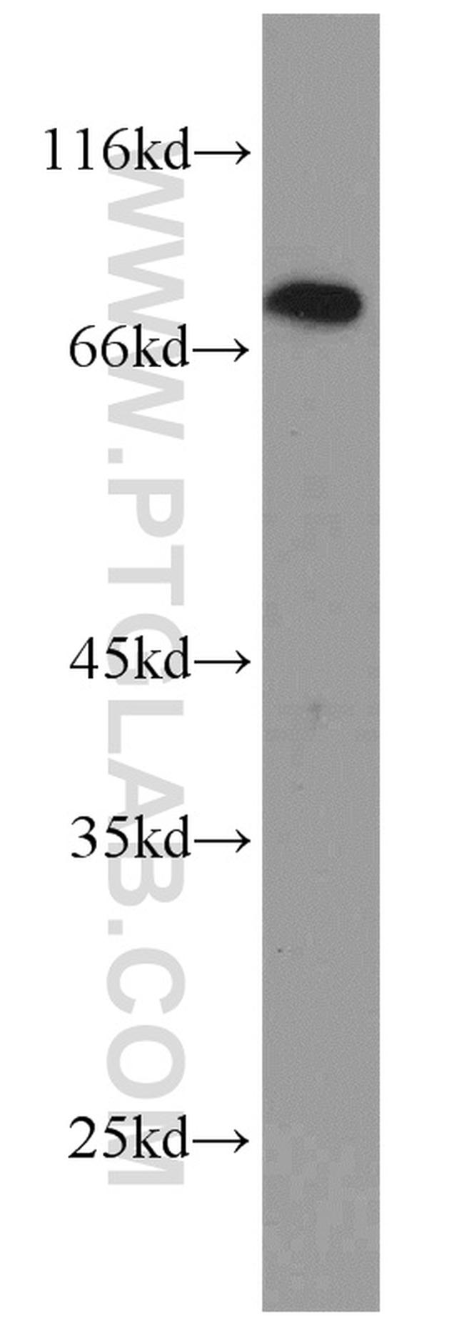 GRK2 Antibody in Western Blot (WB)