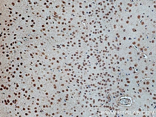 Cryptochrome 2 Antibody in Immunohistochemistry (Paraffin) (IHC (P))