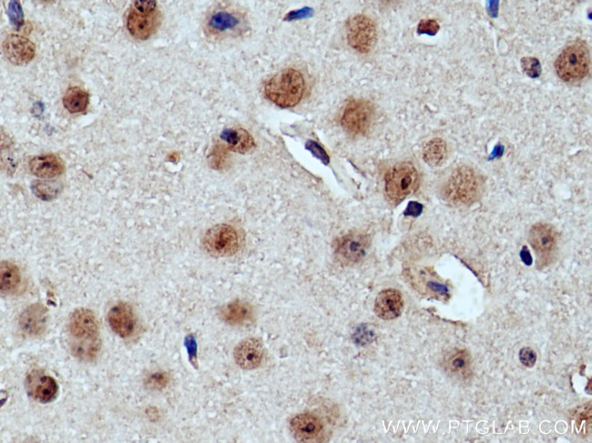 Cryptochrome 2 Antibody in Immunohistochemistry (Paraffin) (IHC (P))