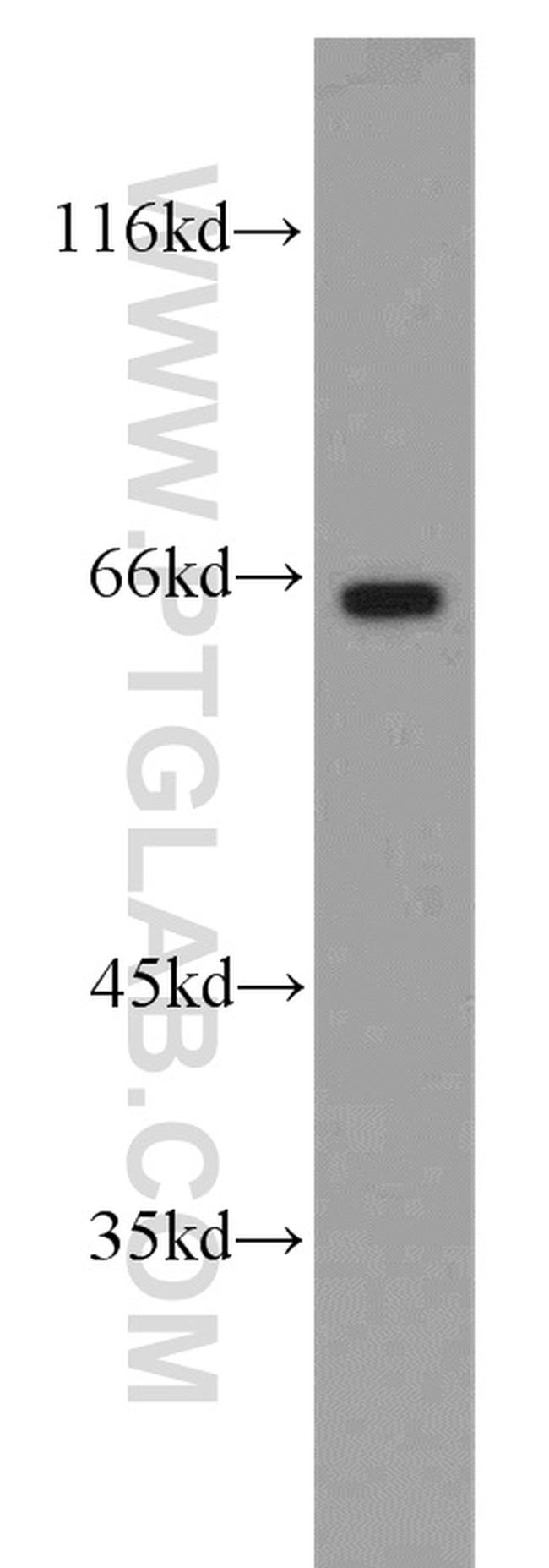 Cryptochrome 2 Antibody in Western Blot (WB)