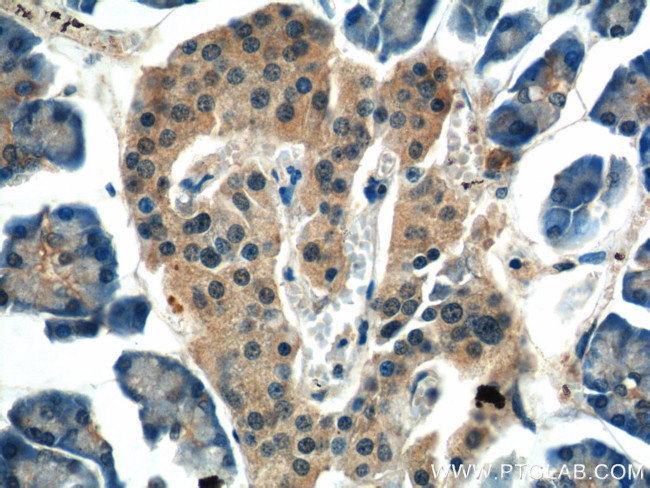 ALS2 Antibody in Immunohistochemistry (Paraffin) (IHC (P))