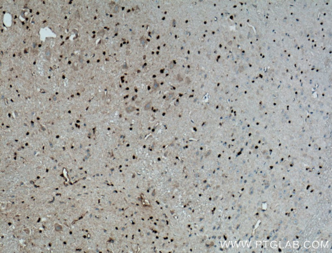 OLIG2 Antibody in Immunohistochemistry (Paraffin) (IHC (P))