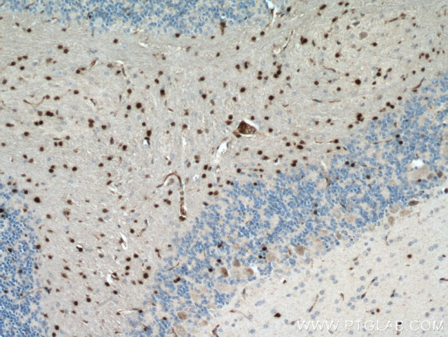 OLIG2 Antibody in Immunohistochemistry (Paraffin) (IHC (P))