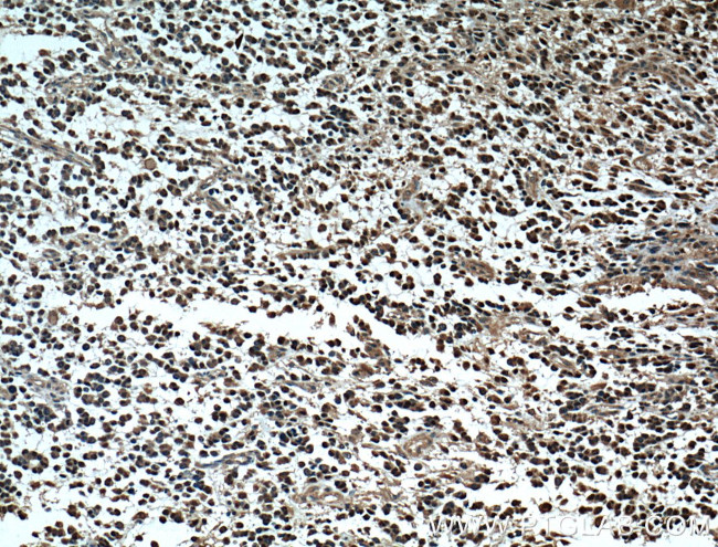 OLIG2 Antibody in Immunohistochemistry (Paraffin) (IHC (P))