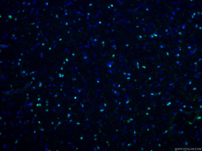 OLIG2 Antibody in Immunohistochemistry (PFA fixed) (IHC (PFA))