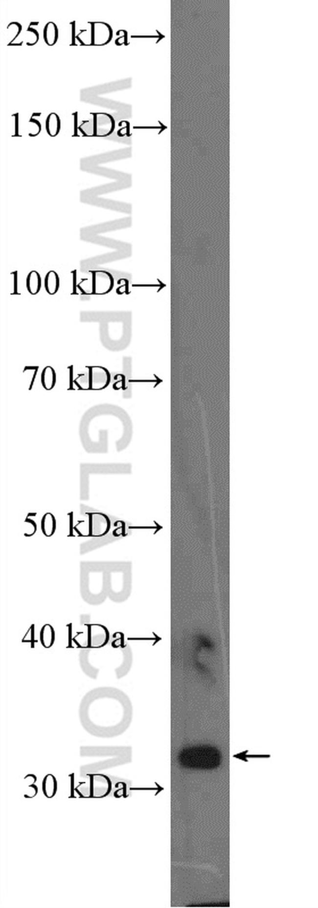 OLIG2 Antibody in Western Blot (WB)