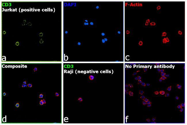 CD3 Antibody in Immunocytochemistry (ICC/IF)