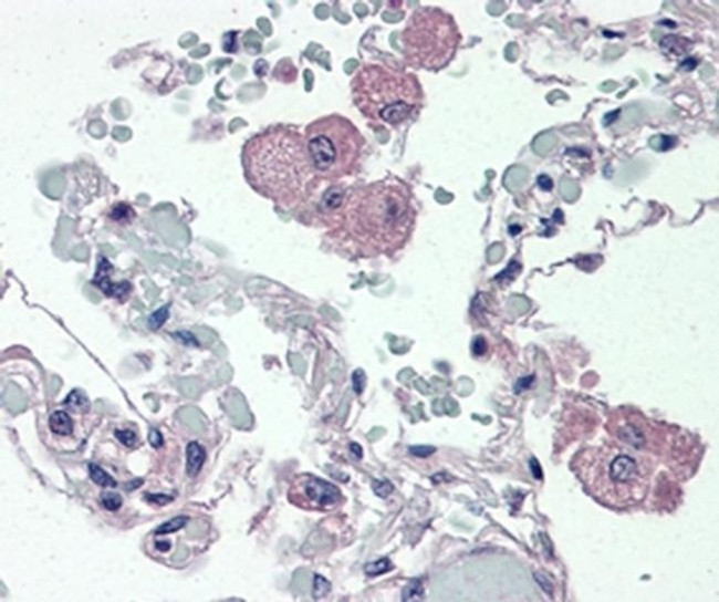 CD14 Antibody in Immunohistochemistry (Paraffin) (IHC (P))