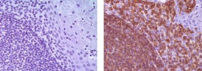 CD19 Antibody in Immunohistochemistry (Paraffin) (IHC (P))